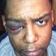 Photo of Taj Patterson taken shortly after the beating he suffered in December.
Youtube